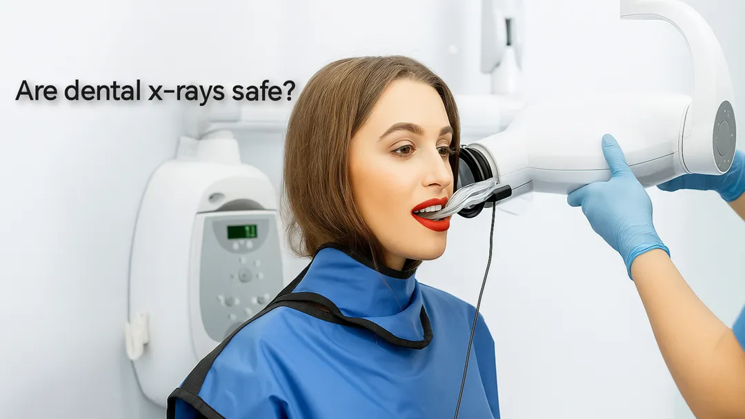 Are dental x rays safe?