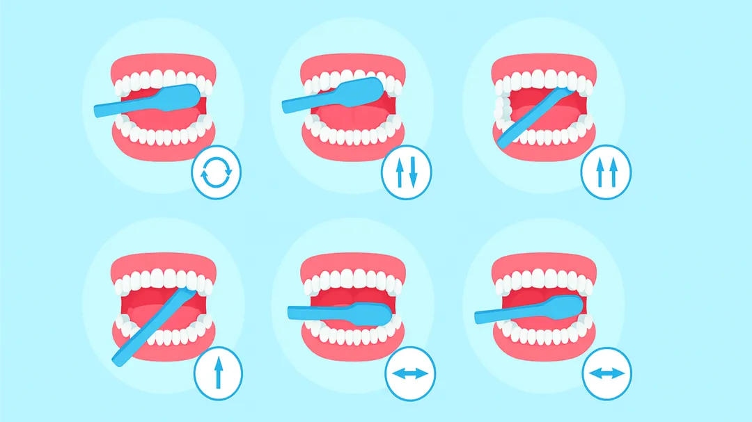 BRUSHING TECHNIQUES:THE KEY TO HEALTHY TEETH AND GUMS.