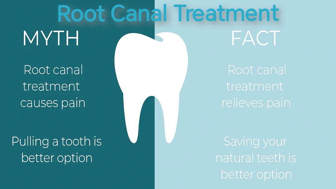 MYTHS ABOUT ROOT CANAL TREATMENT!