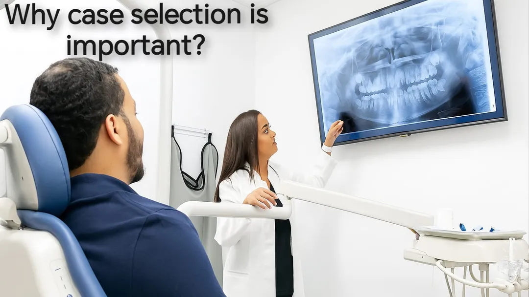 WHY CASE SELECTION IS IMPORTANT ?