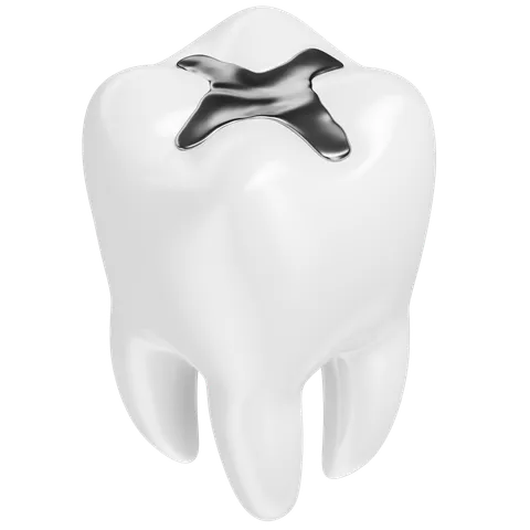 Dental Fillings