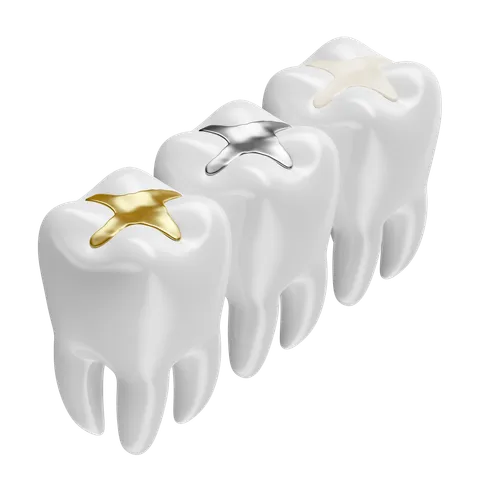 Dental Sealants
