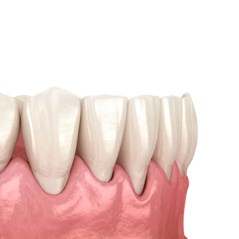 Periodontal Therapy