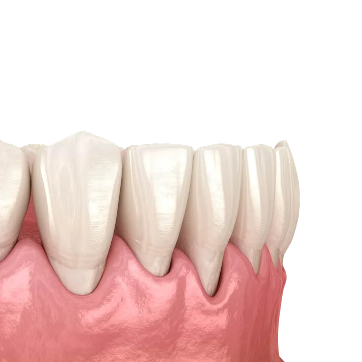 Periodontal Therapy