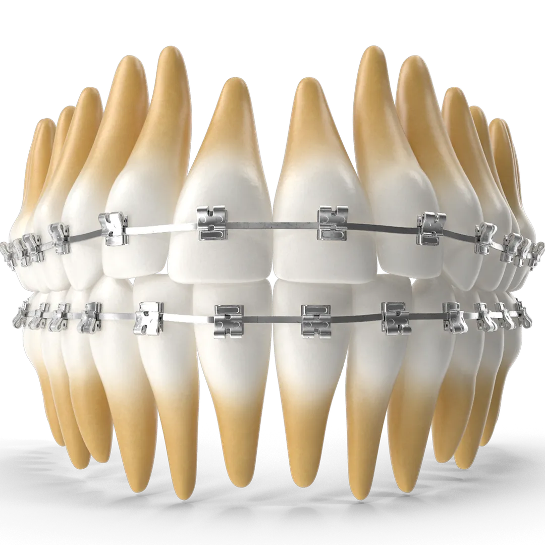 Image of teeth with braces