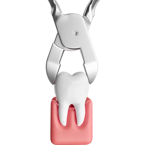 Surgical Extraction